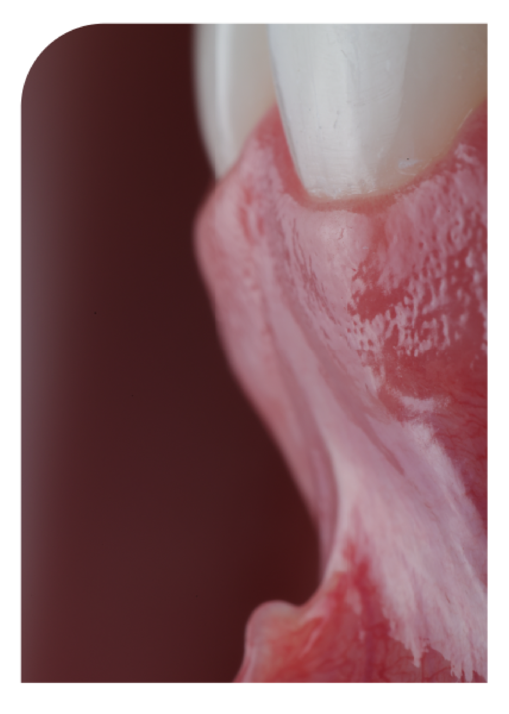 Periodontia — saúde gengival e periodontal