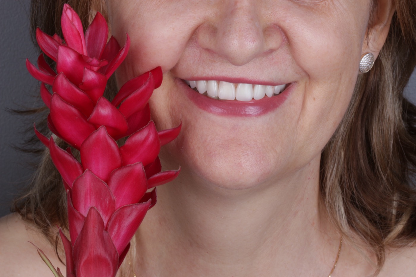 Prótese Dentária — fixa, móvel e sobre implantes