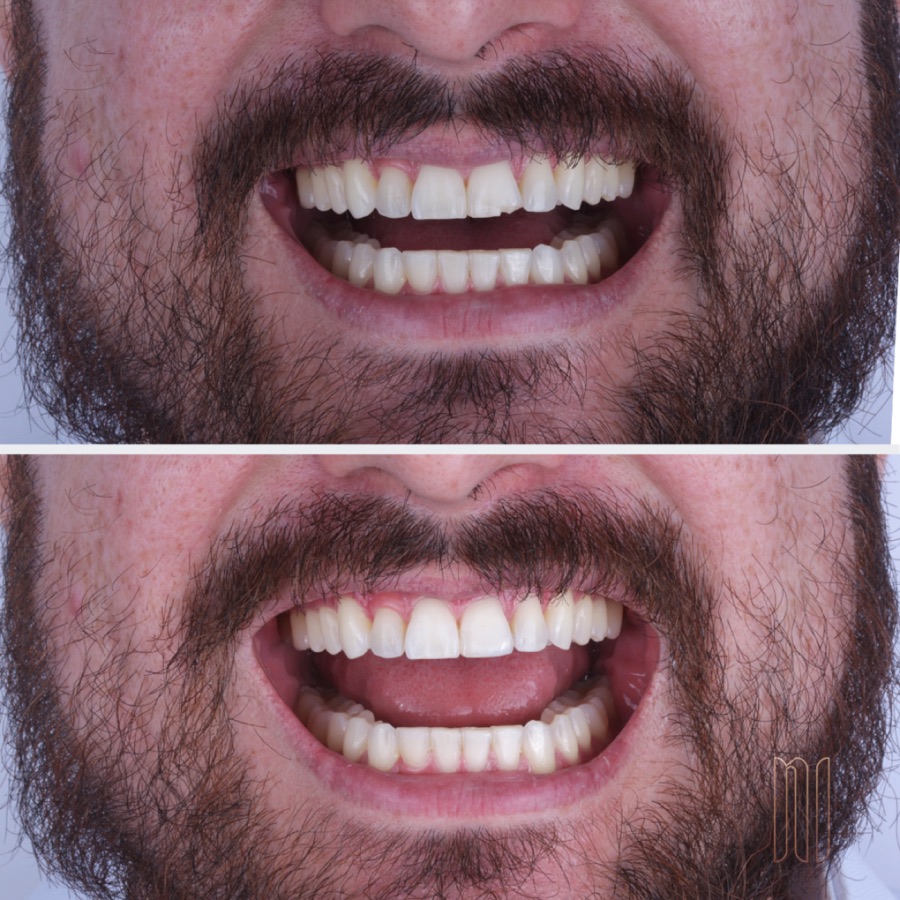 Antes e depois — caso clínico 07